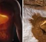 Miracle molecule from licorice root nullifies liver damage from alcohol and Tylenol…