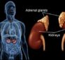 Dr. Berg explains adrenal fatigue and all of its symptoms.