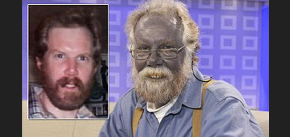 colloidal silver blue man dies colloidal silver blue man dies