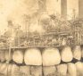 They Pull 10 Million Teeth a Year — Dark Secret of Dental Industry